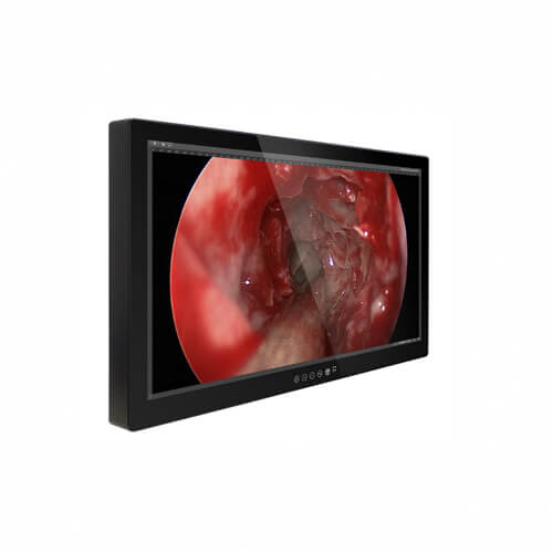 Tomlinson M320TF 32" 4K Surgical Display