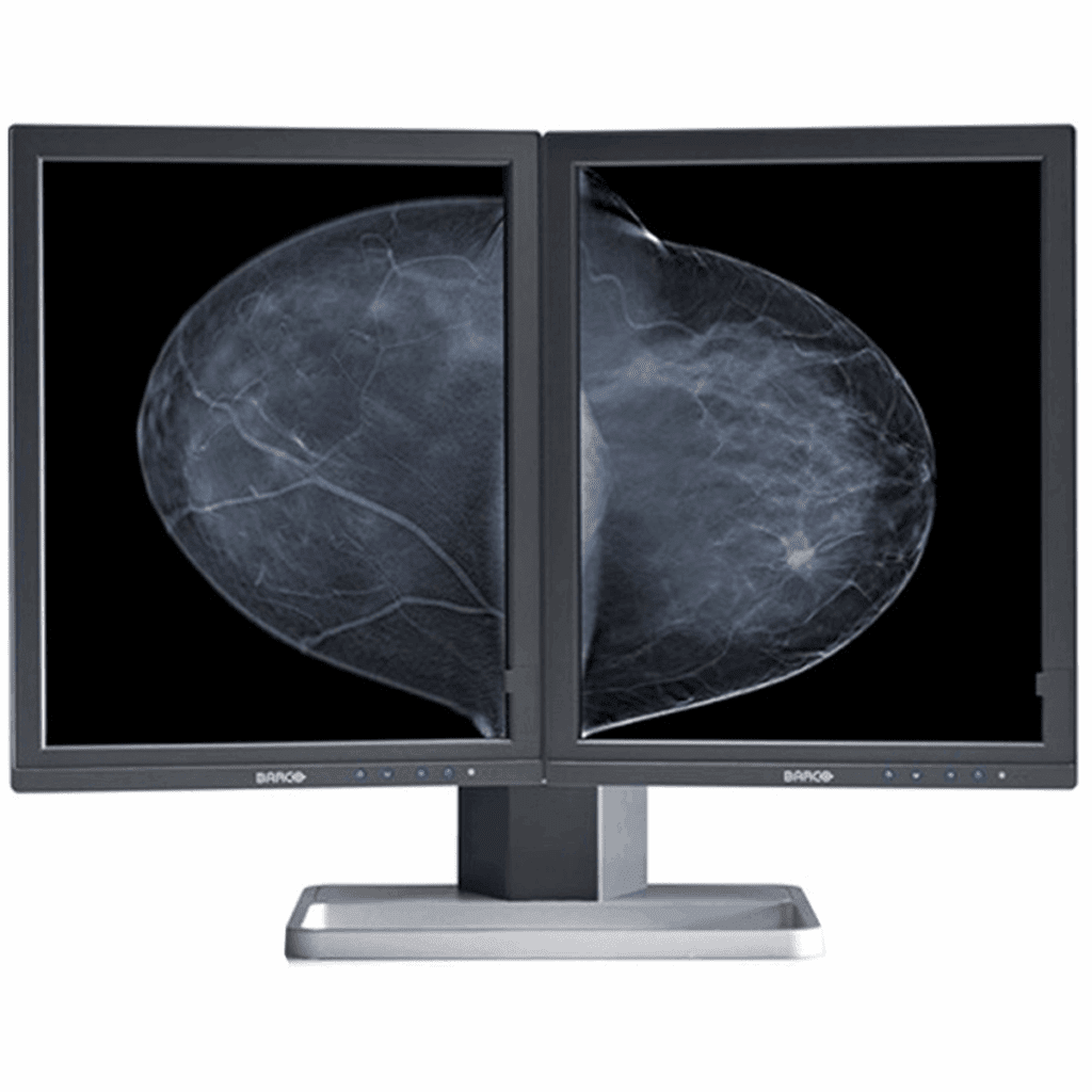 Barco MDMG-5221 Mammo Display - MDMG5221