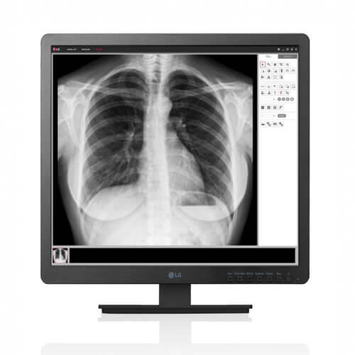 LG 19HK312C-B 19" Clinical Review Display