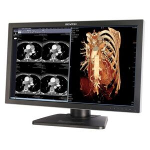 Beacon C82W+ 8MP Dual-Screen Color Radiology Monitor