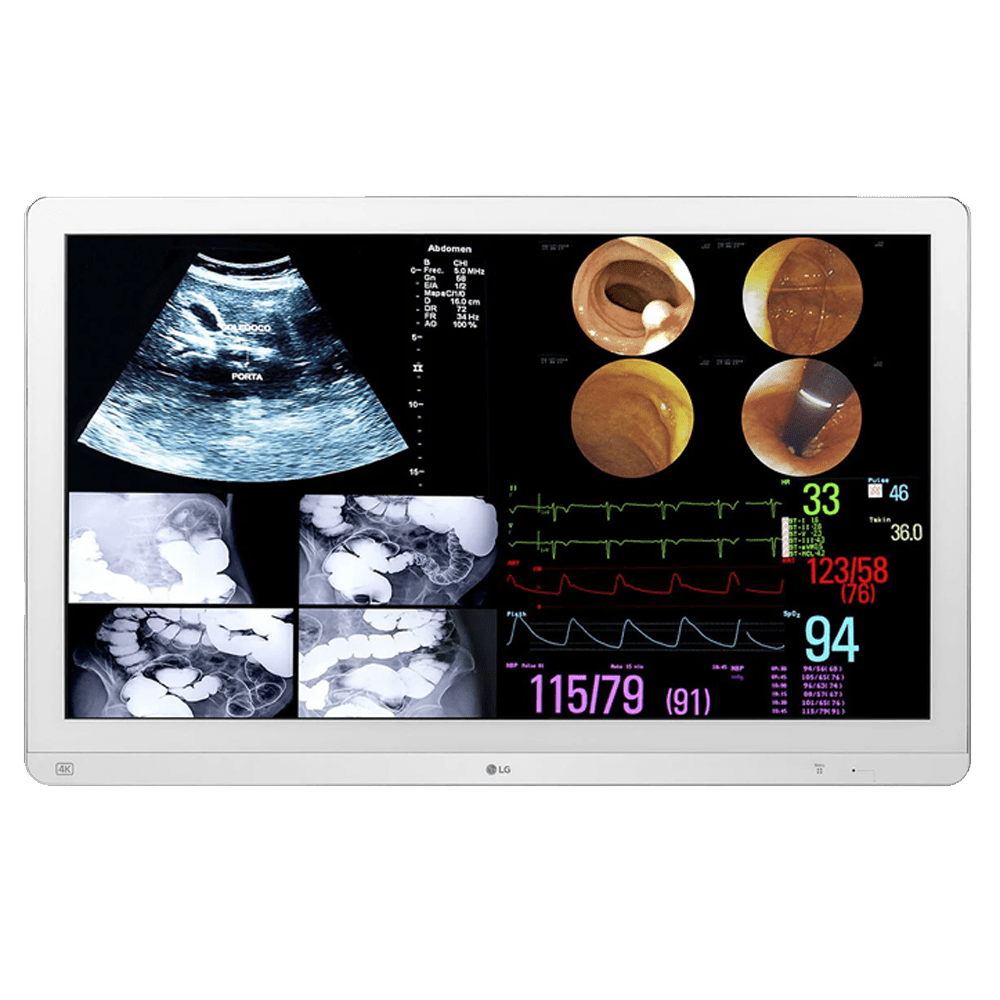 LG 32HL714S-W 31.5-inch Surgical Display Monitor - 32HL714SW