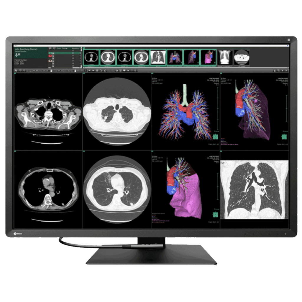 Eizo RadiForce RX1270 Diagnostic Radiology Monitor