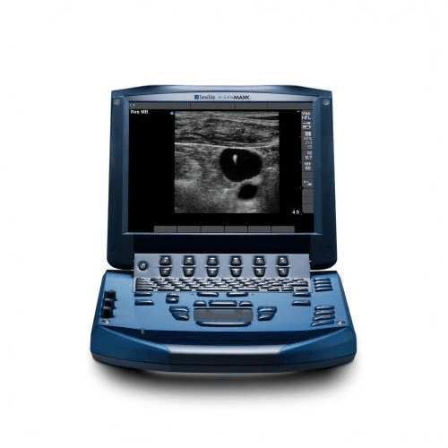 SonoSite Micromaxx Portable Ultrasound System