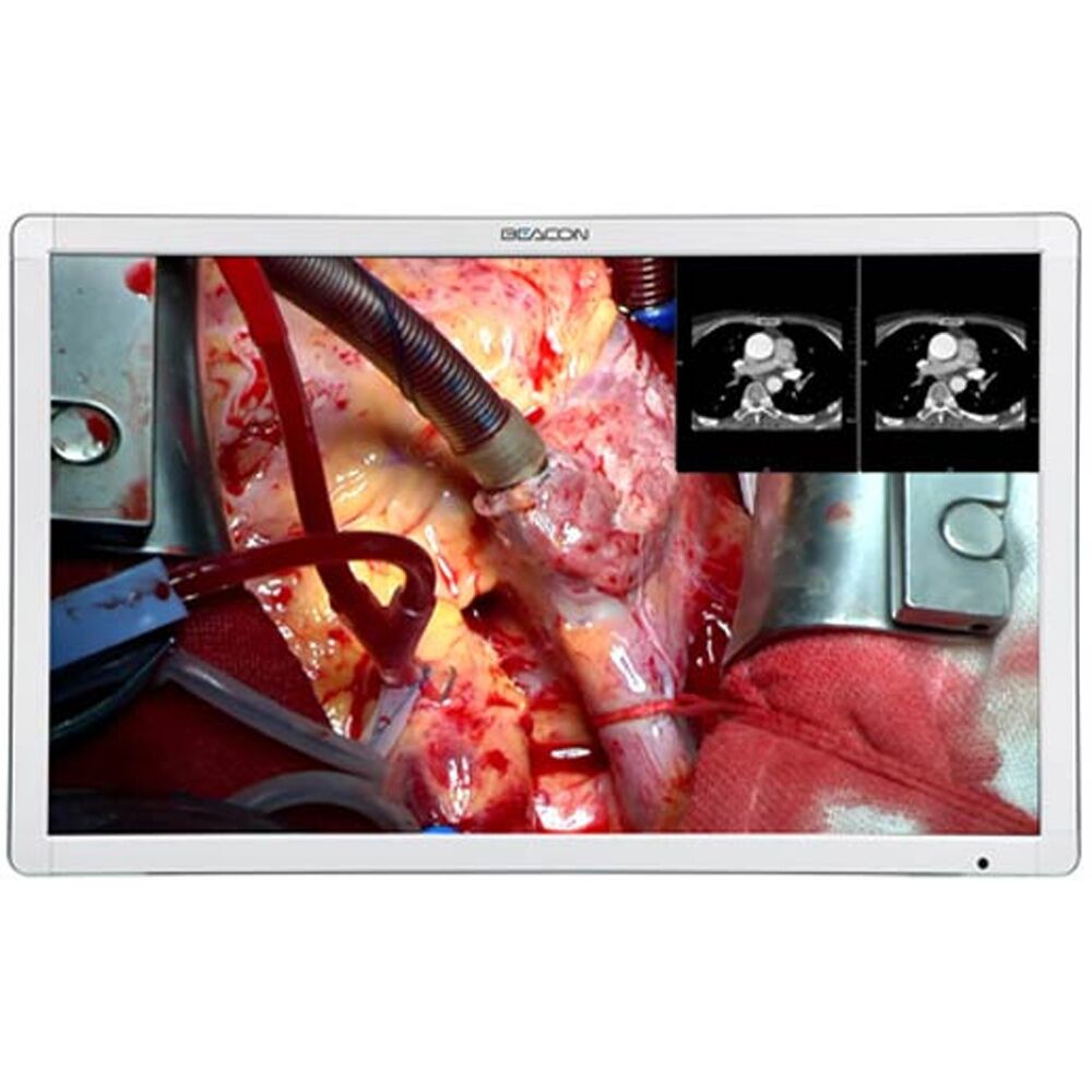 Beacon S421 42-inch Full HD Surgical Display Monitor