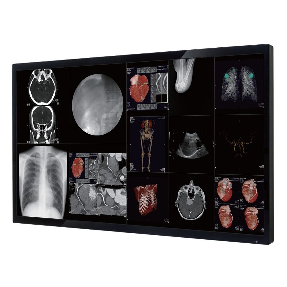 Optik View DC5821 58" 4K Surgical Display