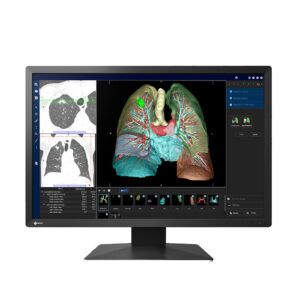 Eizo MX242W-BK 24-inch Diagnostic Display - Hiliex Inc.