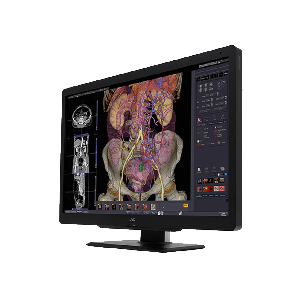 JVC CL-S600 6MP Medical Monitor - CLS600