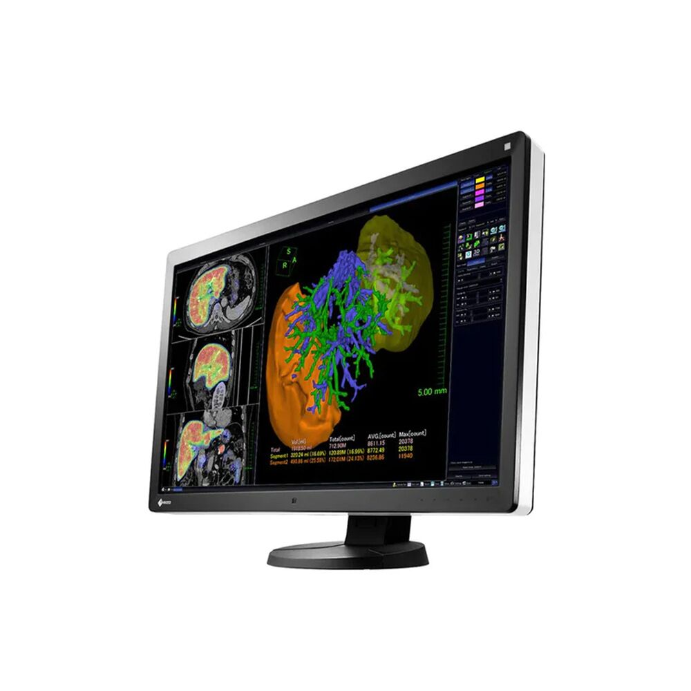 Eizo RX650 6MP