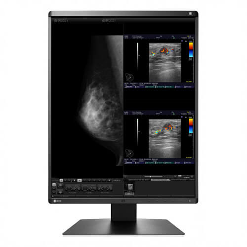 Eizo RX560
