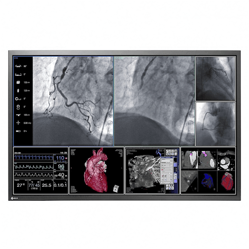 Eizo RadiForce LS580W