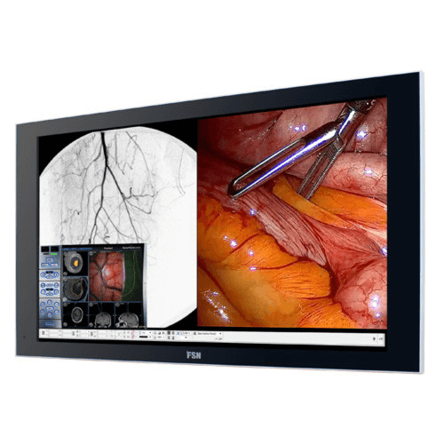 FSN FS-S4601DT