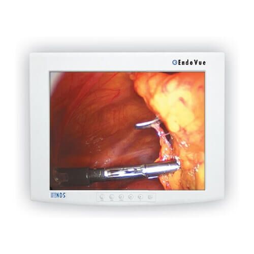 NDS 15in EndoVue (90K0005)