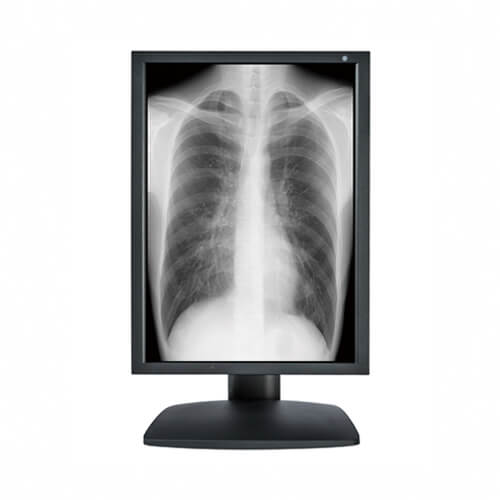 Optik View DM21310