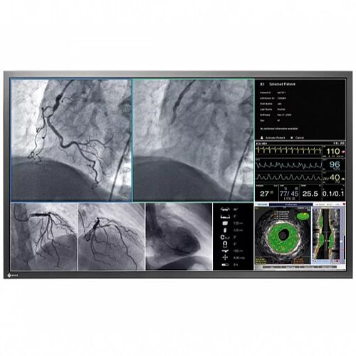 Eizo Radiforce LL580W