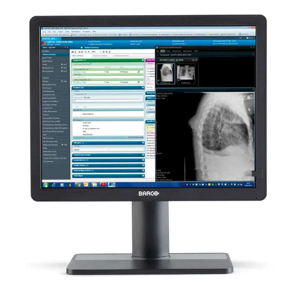 Barco MDRC-2421