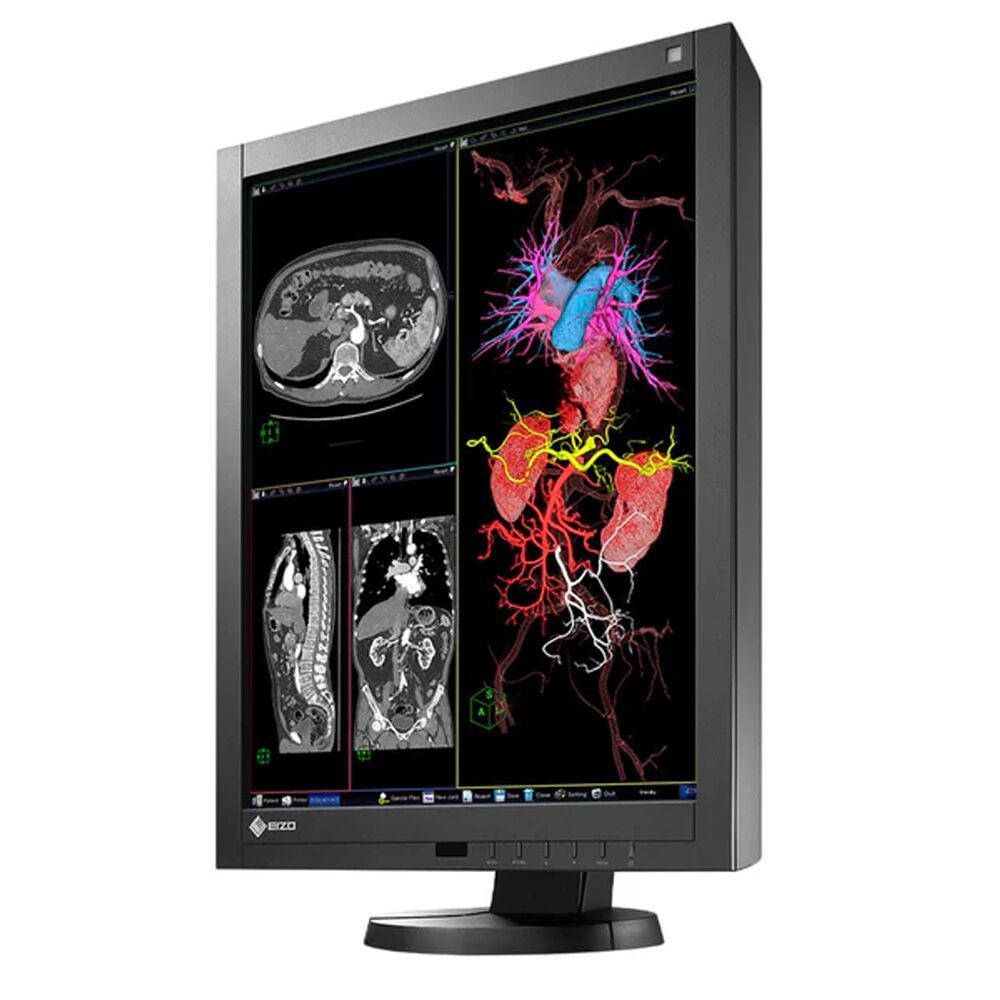 Eizo RX240 2MP