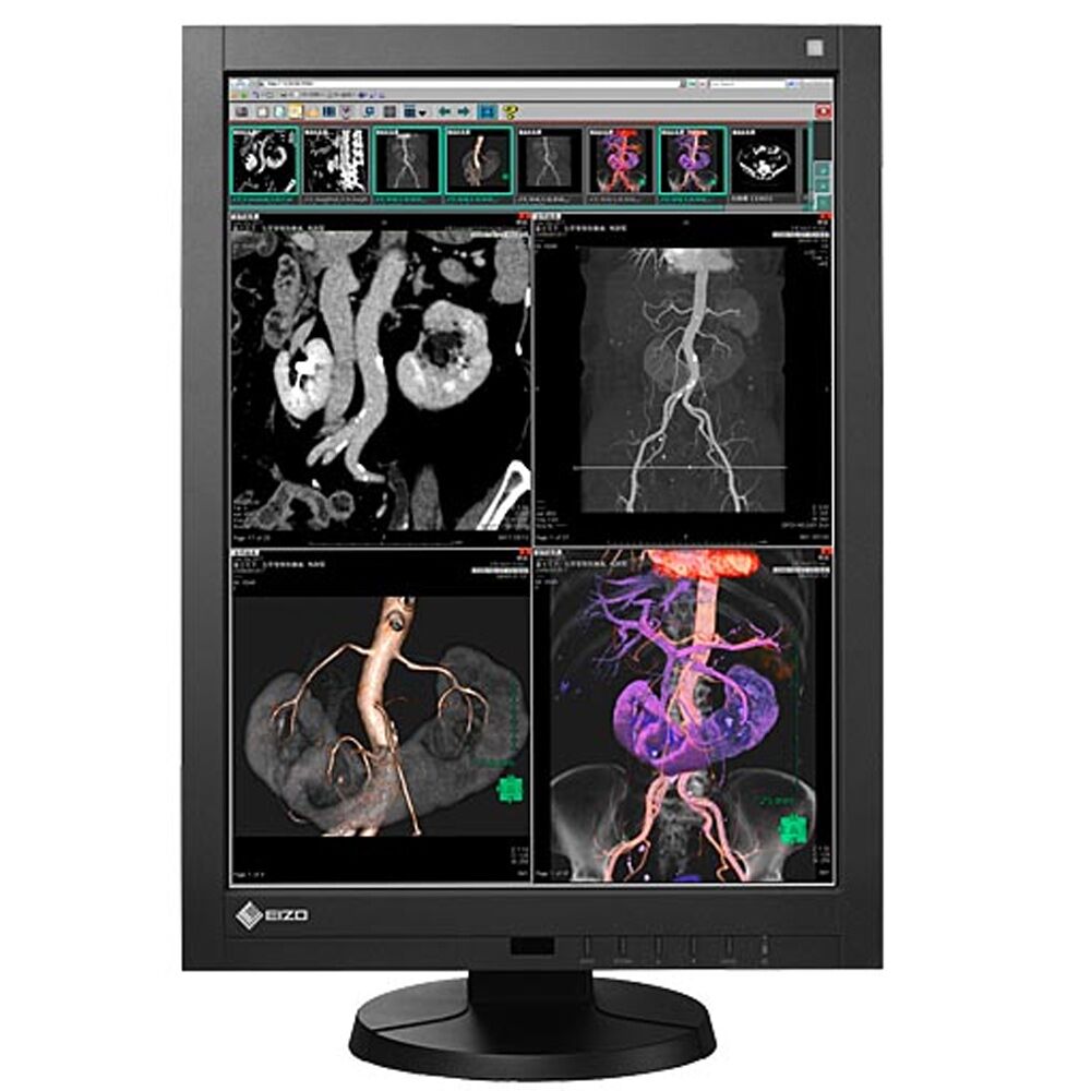 Eizo RX340 3MP Color