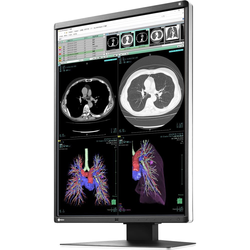 Eizo RX360 3MP Color