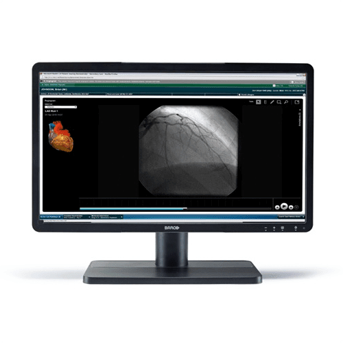 Barco MDRC-2122 BL Eonis 22"