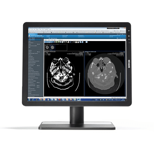 Barco MDRC-2221 Eonis 21"