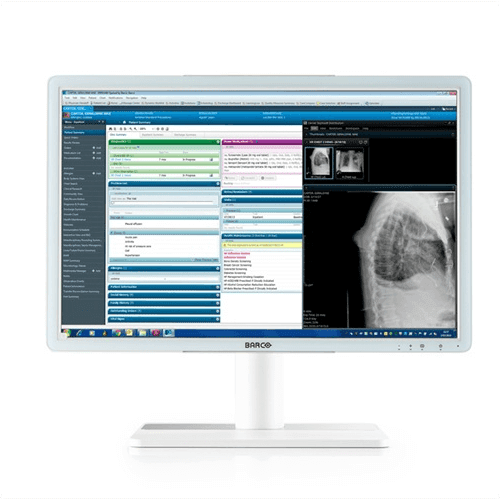 Barco MDRC-2224 WP Eonis 24"