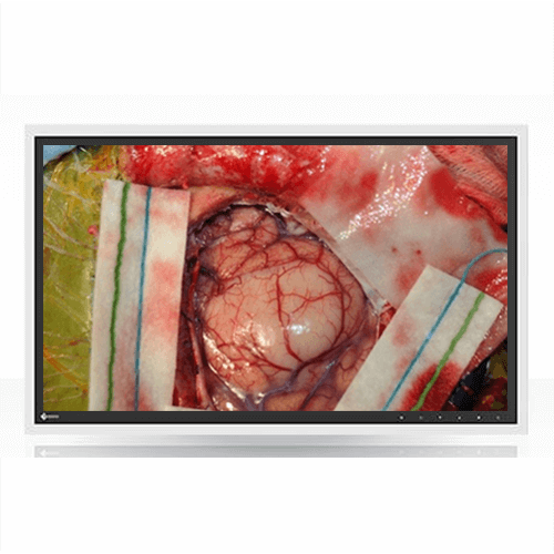 Eizo EX270W 27" FHD Surgical Display