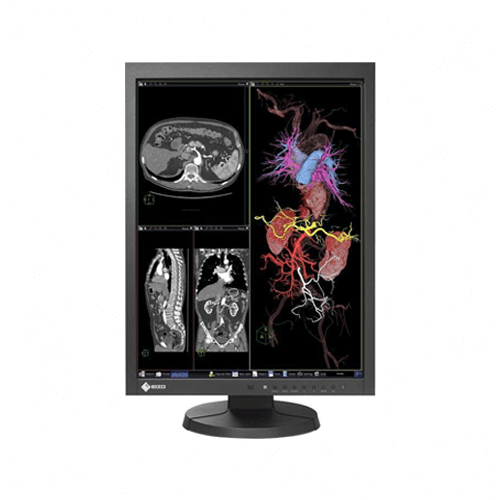 Eizo MX215