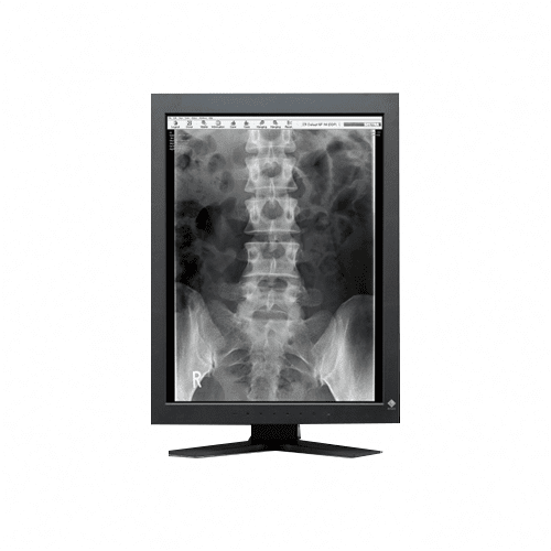 Eizo GS220 2MP Grayscale Diagnostic Display (GS220BK)