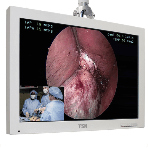 FSN FS-L3202D 32” High-Bright LED Surgical Display