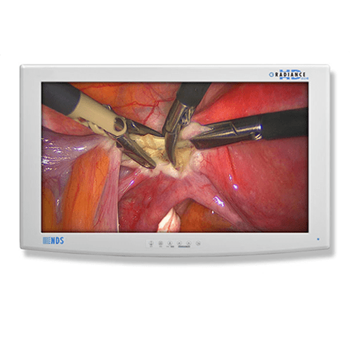 NDS RADIANCE ULTRA 27" Surgical Display