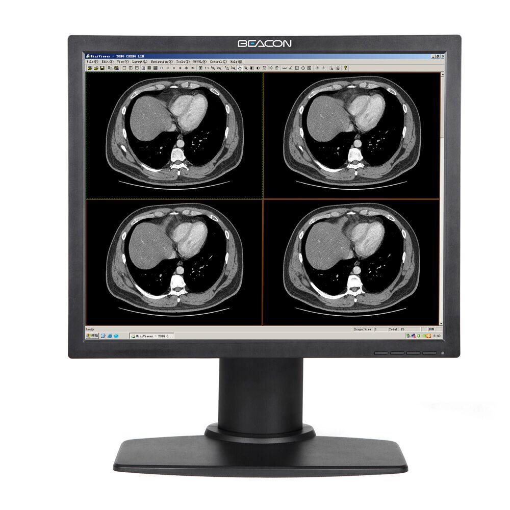 Beacon C14S 1MP Color Medical Display Monitor