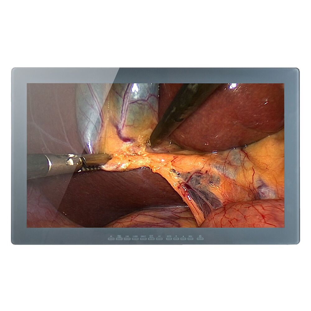Optik View SC2412 24" WUXGA Surgical Display