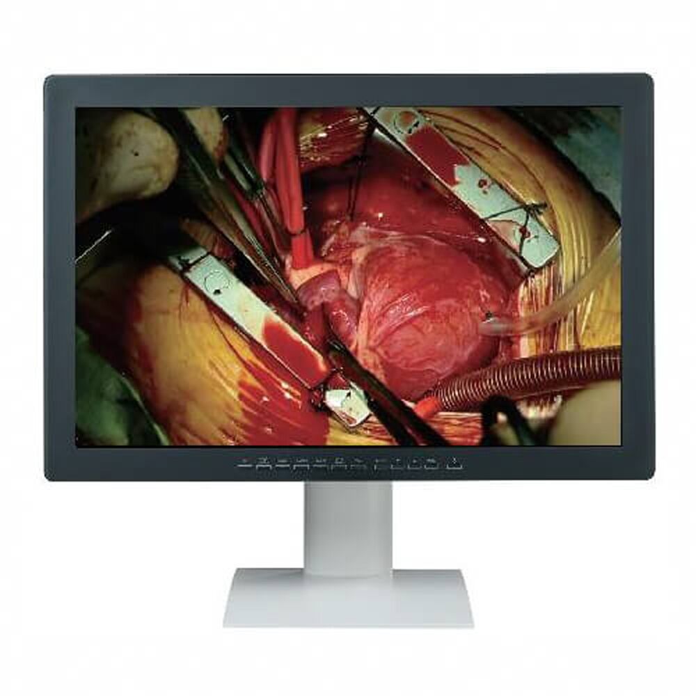 Optik View SC3181X 31.5" 4K Surgical Display