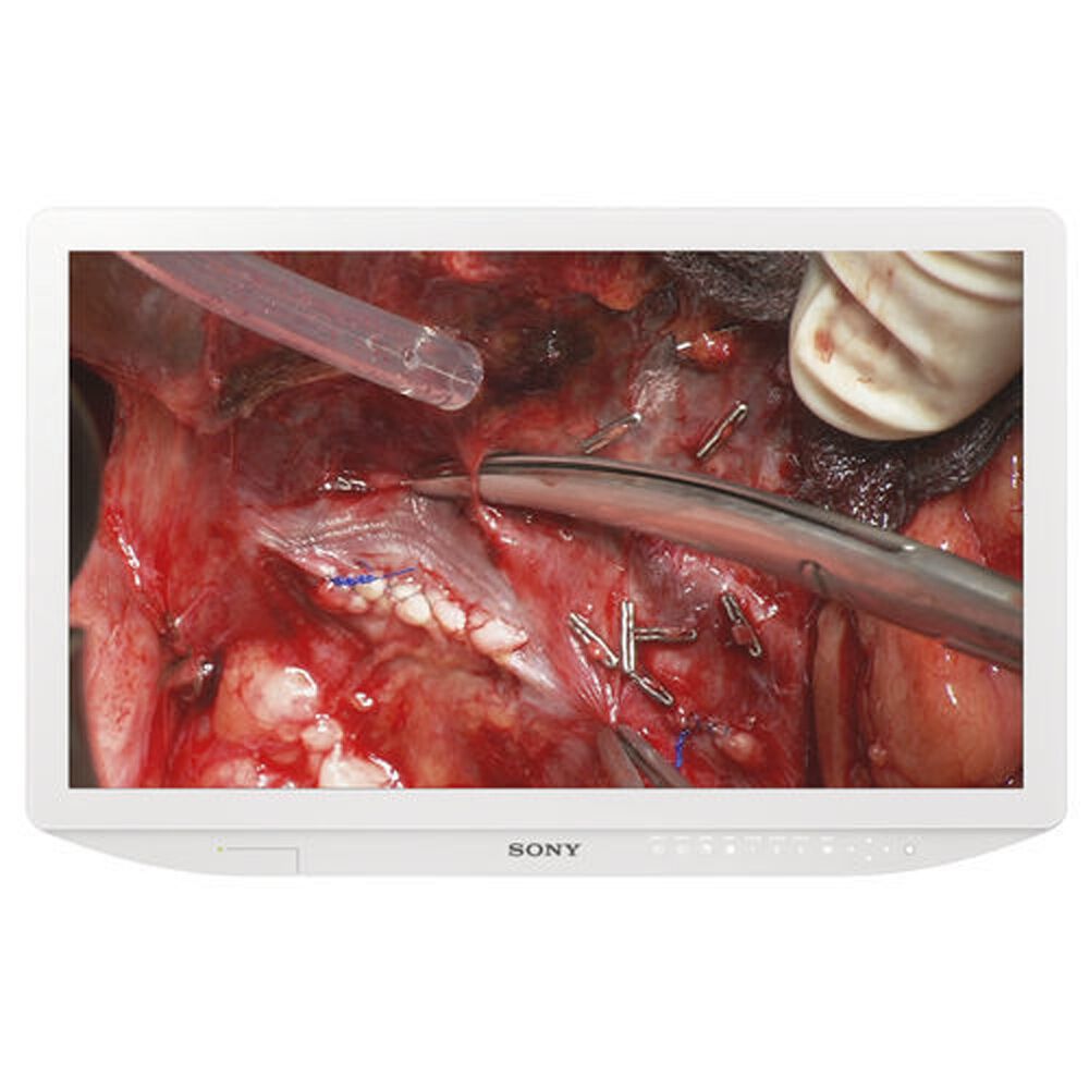 Sony LMD-2735MD 27-inch Full HD 2D LCD Medical Monitor - LMD2735MD