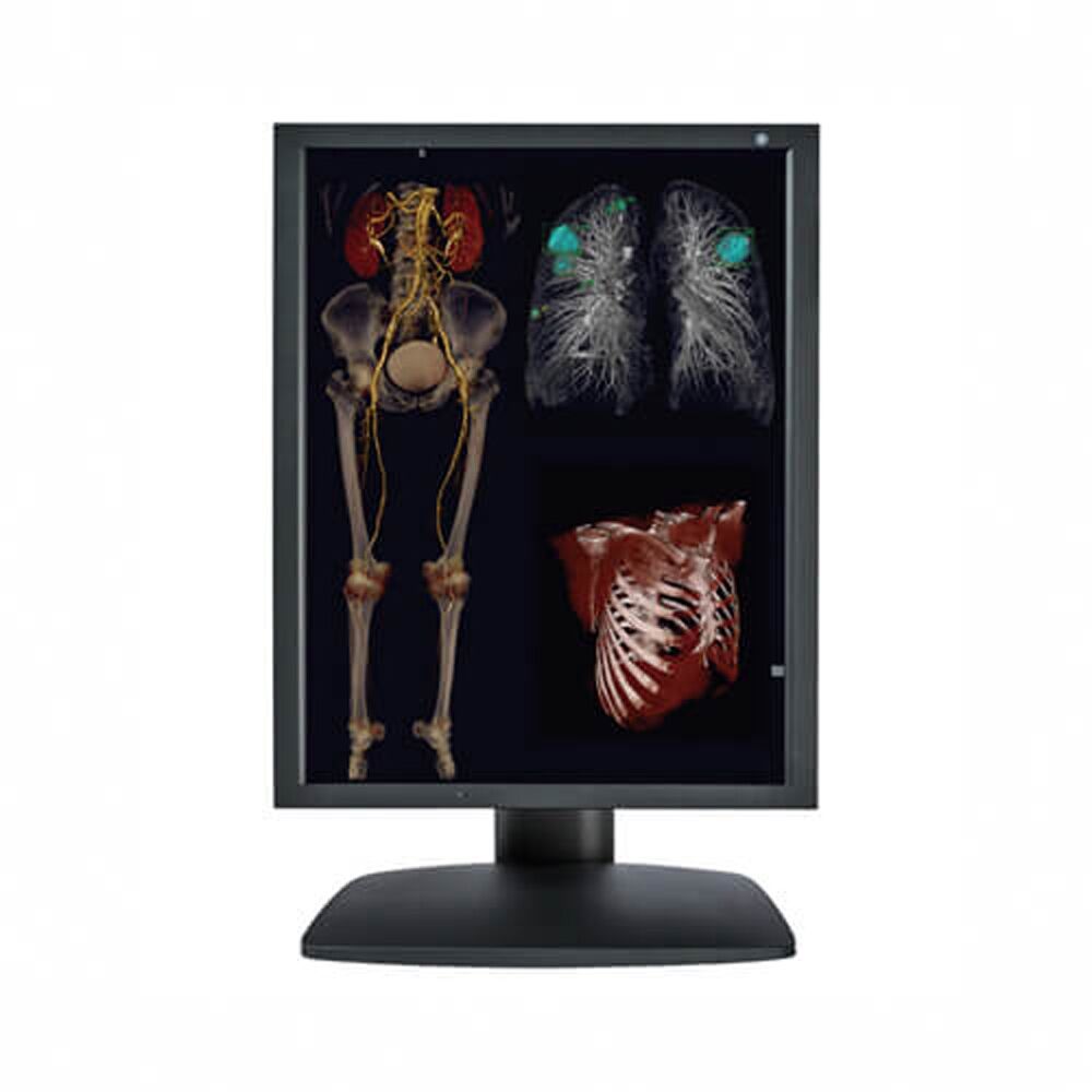 Optik View DC21210 2MP Color Diagnostic Display