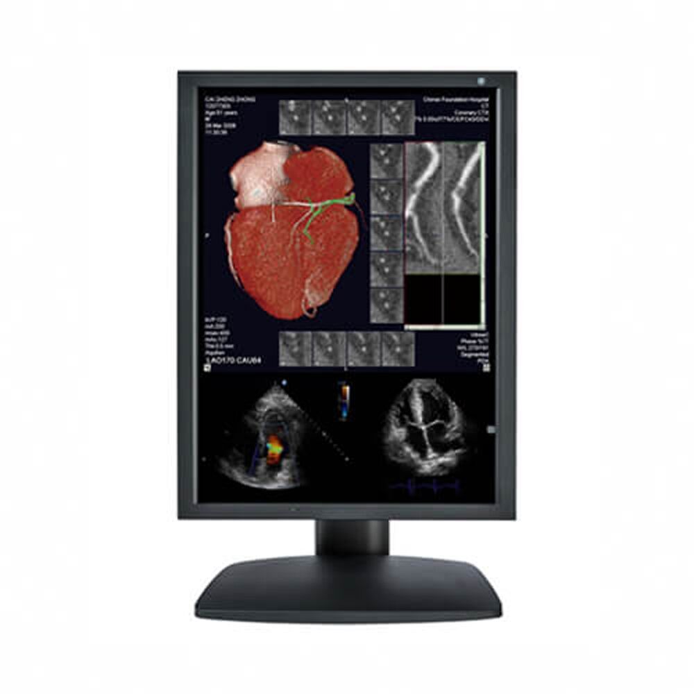 Optik View DC21311 3MP Color Diagnostic Display Monitor for Radiology