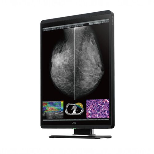 JVC CL-S500 21.3-inch 5MP Color Mammography Display - CLS500