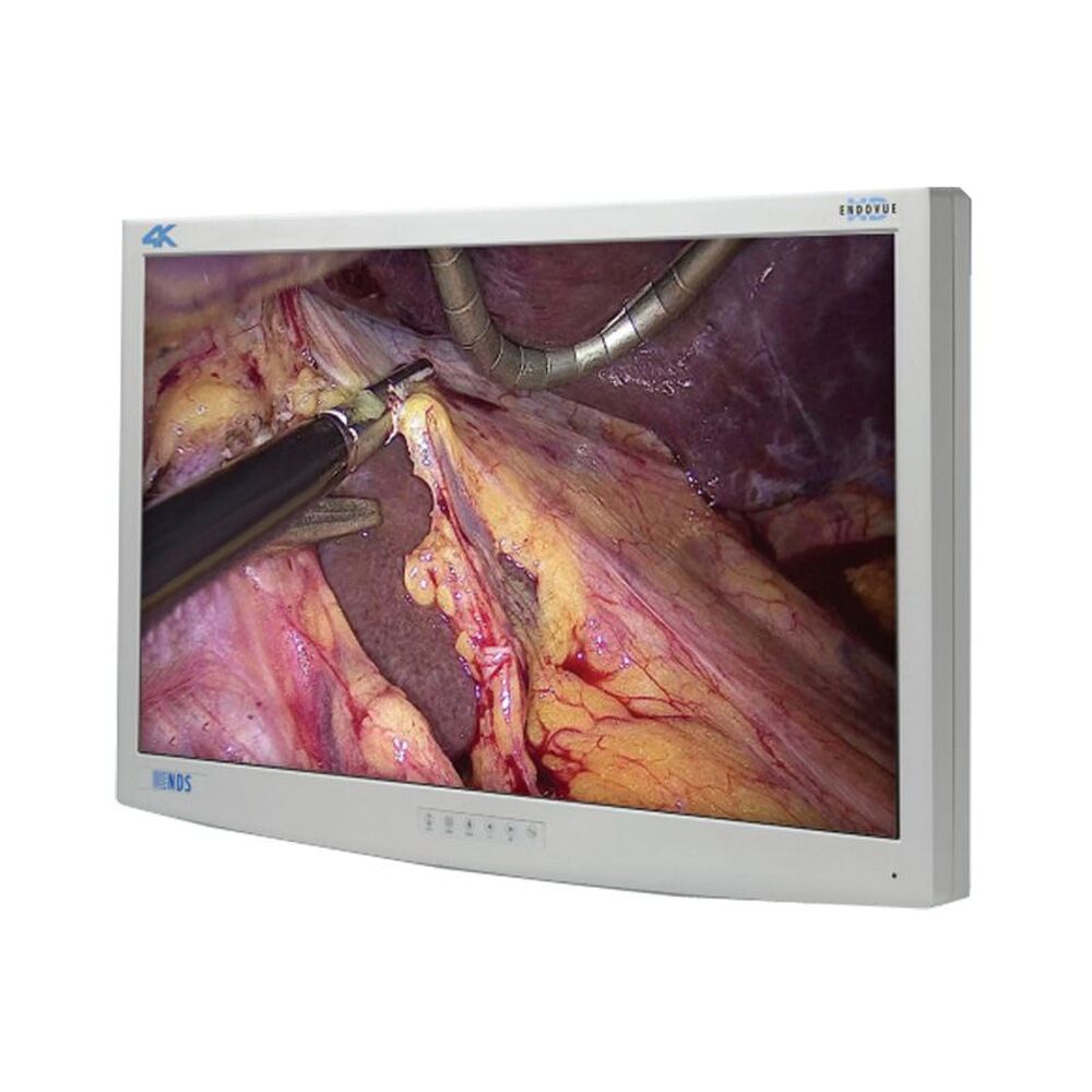 NDS EndoVue Plus 32" 4K Surgical Display Monitor