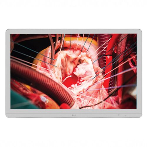 LG 27HQ710S-W 27" 4K Mini-LED Surgical Display