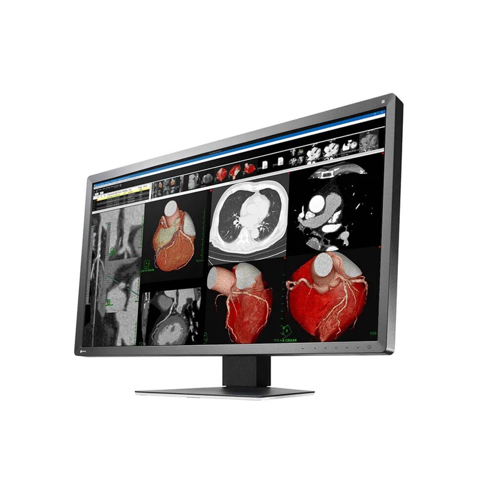 Eizo MX317W (MX317WBK) 8MP Clinical Review Display Monitor