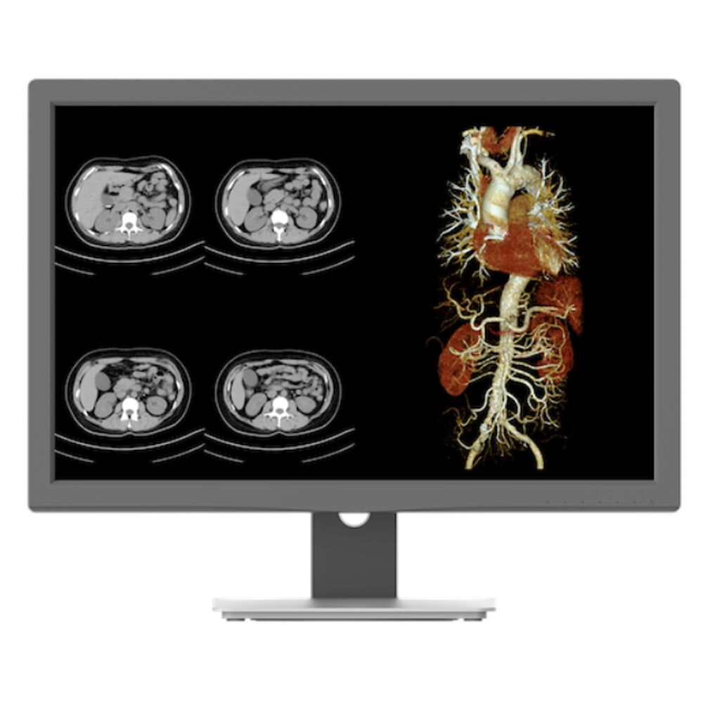 Jusha CR240G 24-inch 2MP Color Clinical Review Display