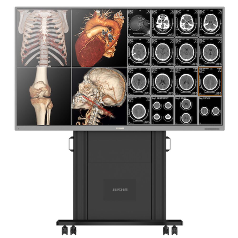Jusha S8420S 8MP 84" Medical Monitor