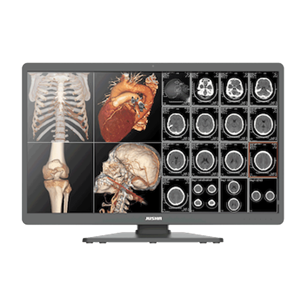 Jusha C820G 31.5-inch 8MP Color Diagnostic Display