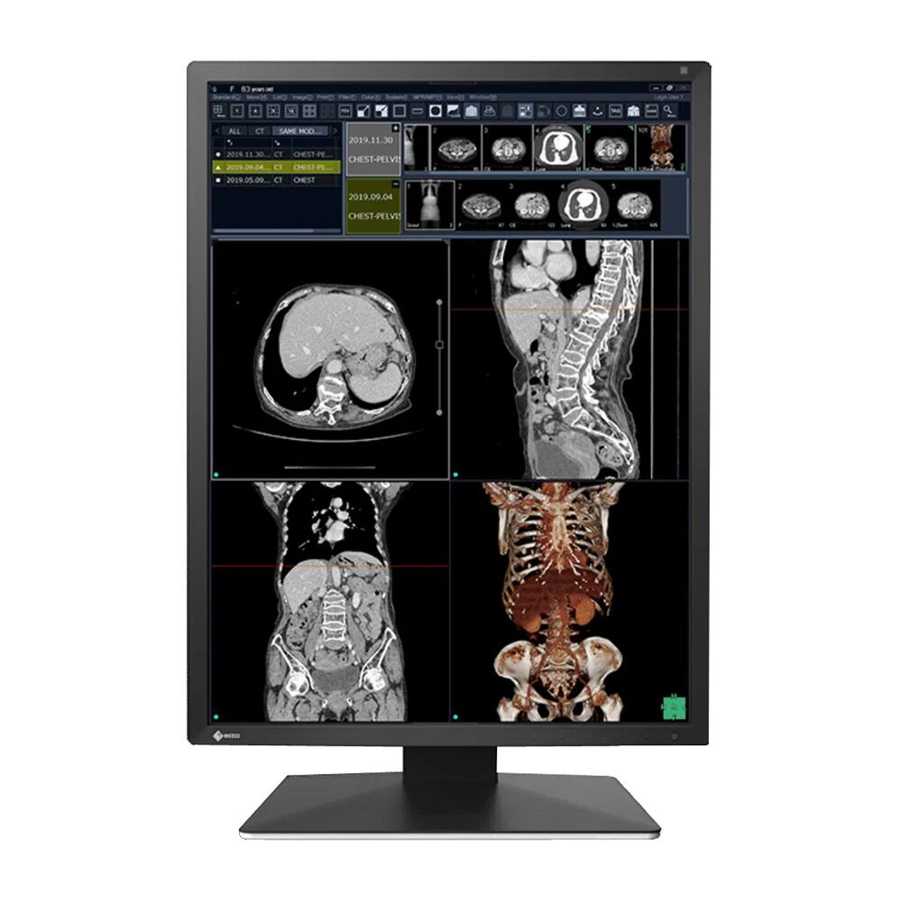 Eizo RadiForce RX270-BK 2MP Diagnostic Radiology Display Monitor