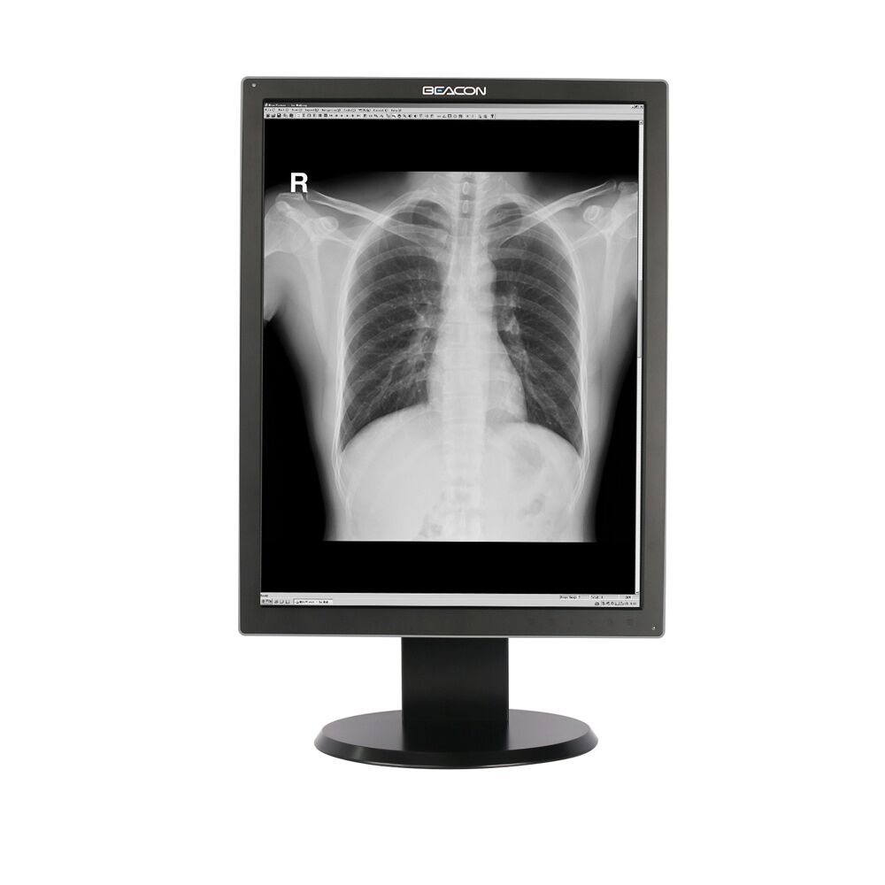 Beacon G23S+ 21.3" 2MP Monochrome LED Diagnostic Radiology Display Monitor