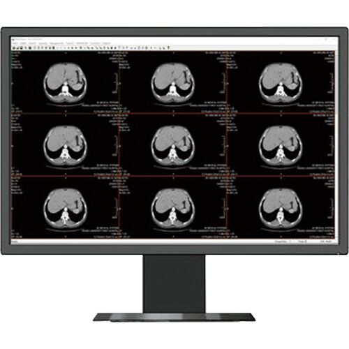 Beacon HL2416SHT Mltifunction Clinical Review Display Monitor