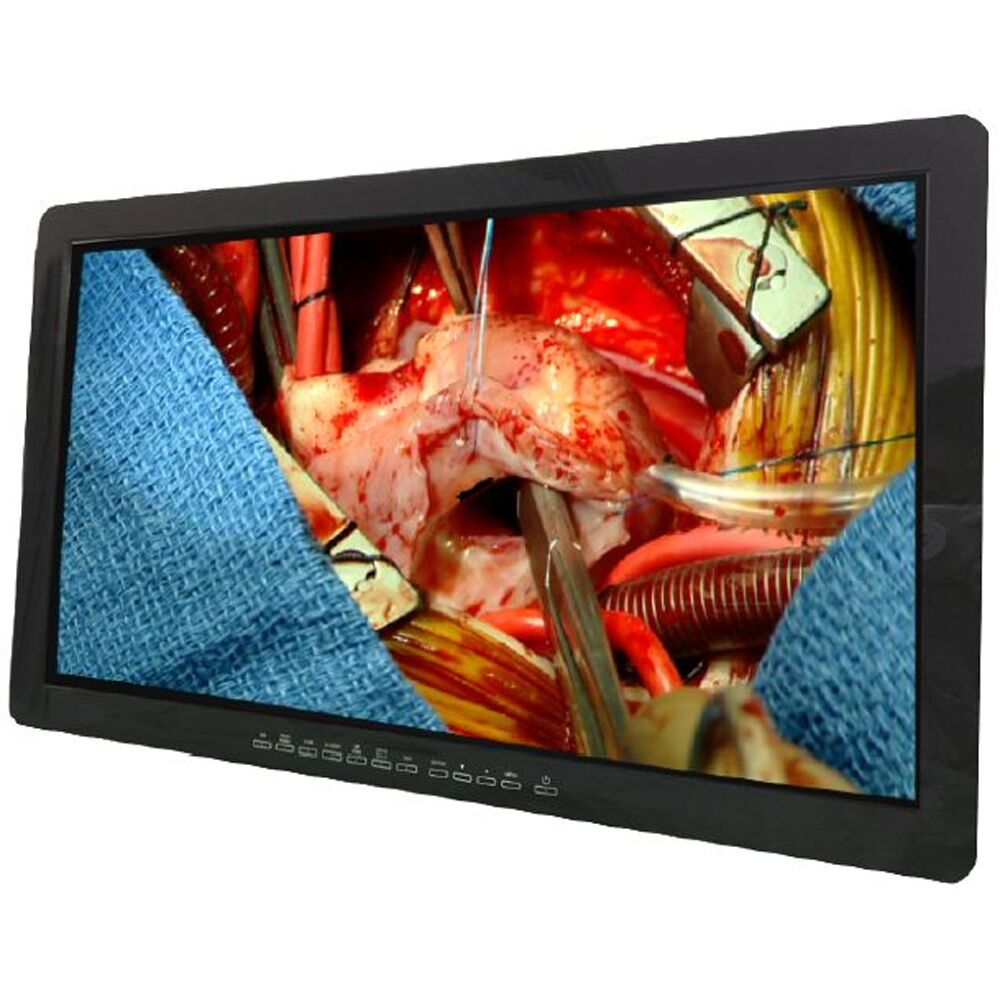 Optik View SC27810 27" 4K Surgical Display