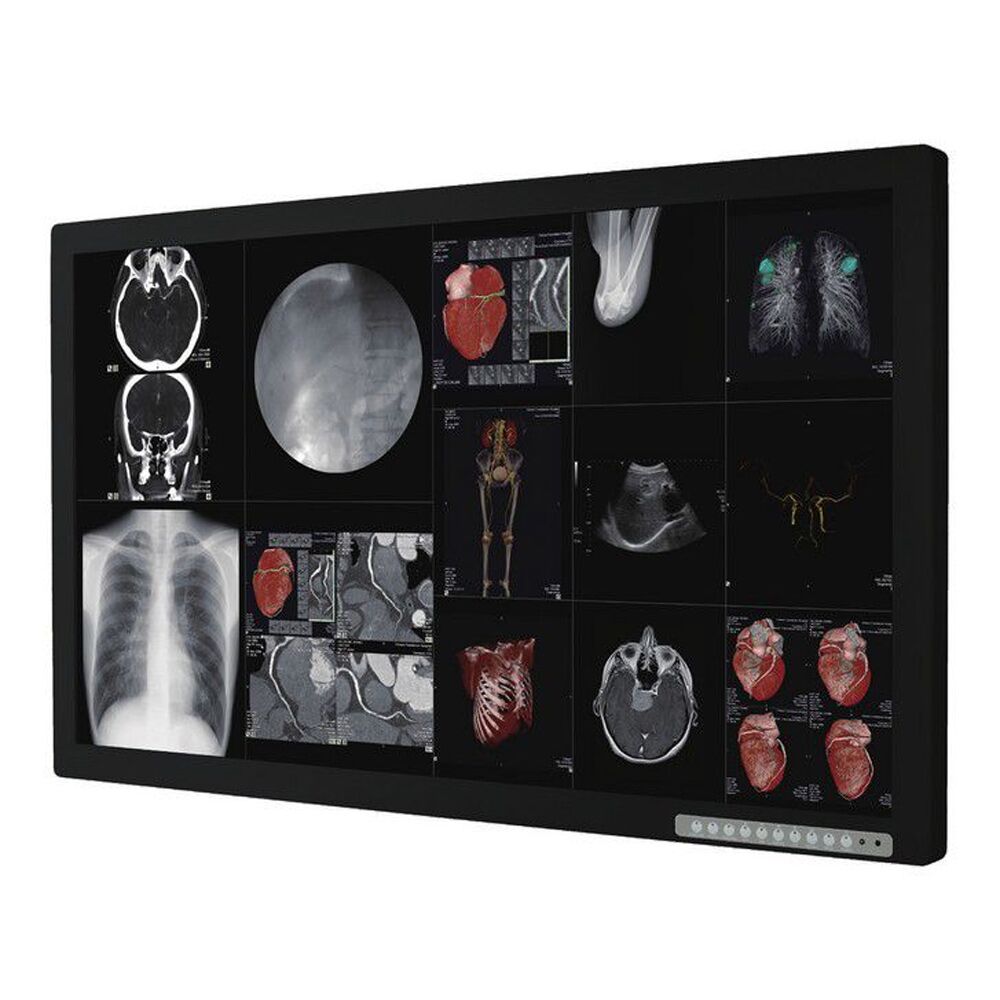 Optik View SC55820 55" 4K Surgical Display Monitor