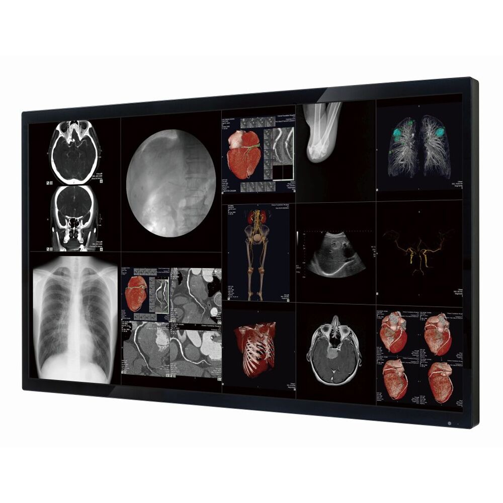 Optik View SC65812 65" 4K Surgical Display