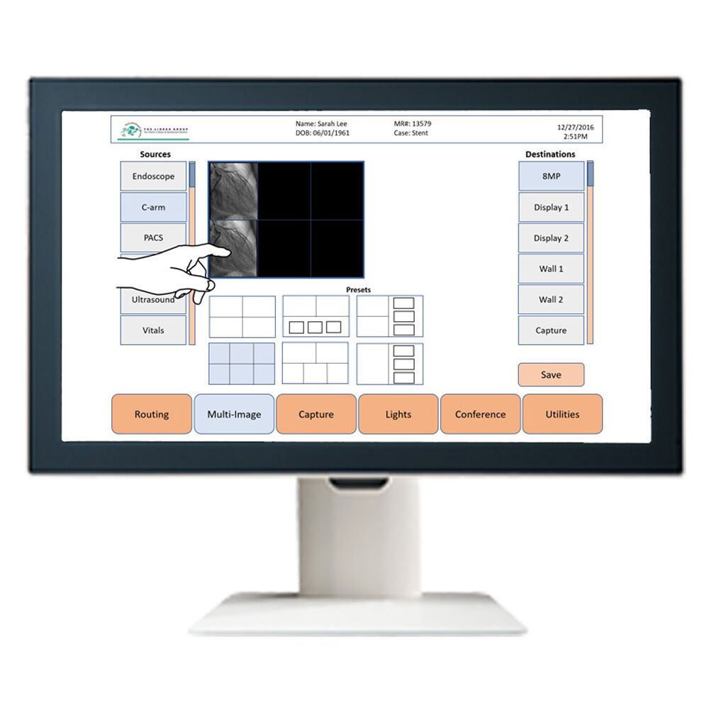 Optik View ST2121X-TP 21.5" FHD Surgical Touch Display